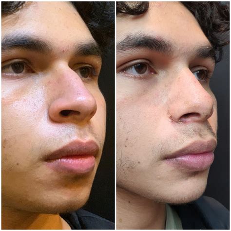 Amazing Before-After Pictures Reveals Jaw-Dropping Results!