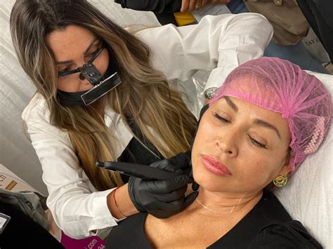 Plasma pen fibroblast training - Beauty Ink Miami