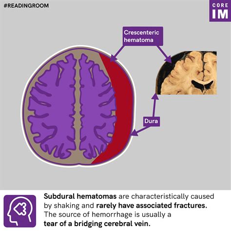 Where are these two hematomas located and how can you tell them apart