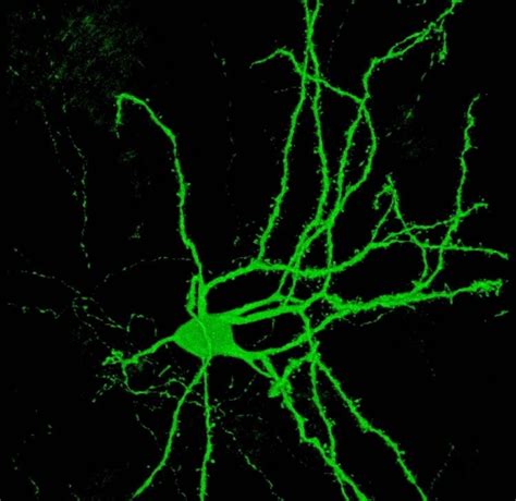 medium spiny neurons news research articles