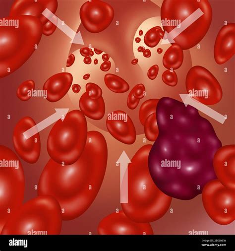 embolus art  res stock photography  images alamy