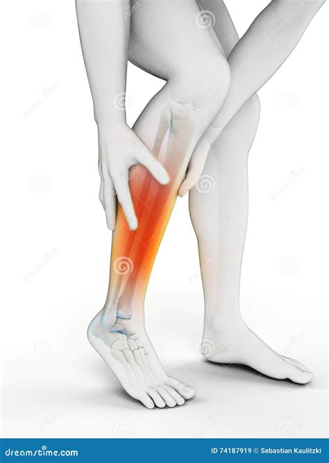 Calf pain stock illustration. Illustration of calf, medical - 74187919