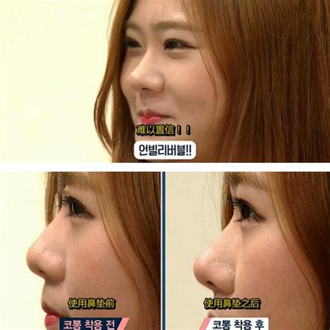 1 Set Women Nose Up Lifting Shaper Nose Bridge Str... – Grandado