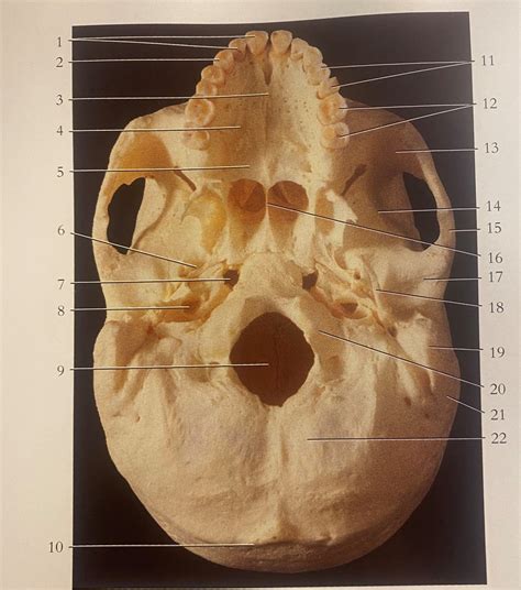 inferior view  human skull diagram quizlet