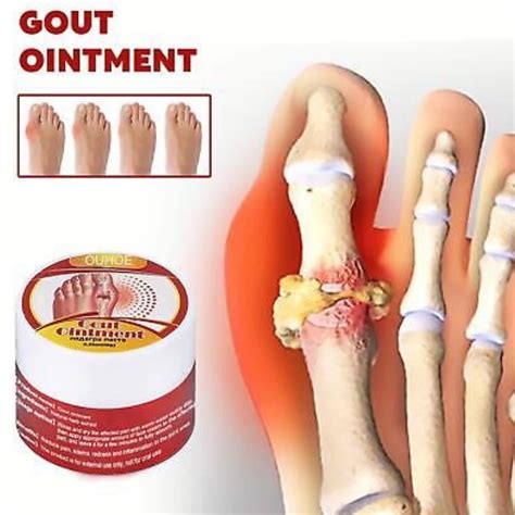 Мазь от подагры и от воспаления косточки на большом пальце Sumifun Gout ...