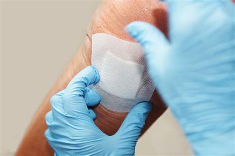 care   undermining wound  dakins solution