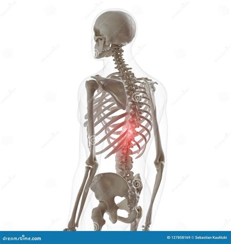 Pain in the lower spine stock illustration. Illustration of backache