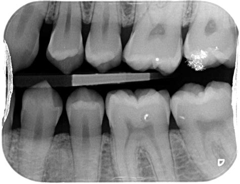 types  dental radiographs    dentalnotebook