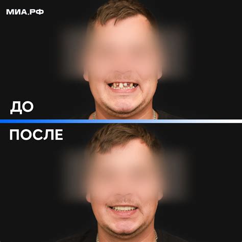 Стоматология МИА.РФ 🦷 МСК и СПБ (@miaclinicstom) • Instagram photos and ...