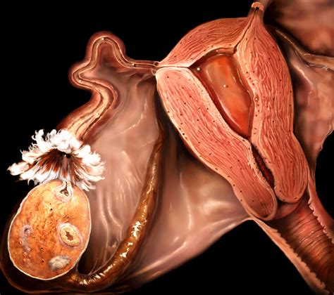 Ovary Diagram Body