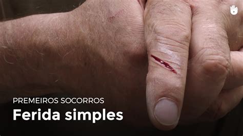 ferida simple primeiros socorros youtube