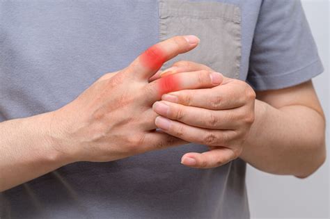 Лечение подагры: способы, лекарства, методы профилактики