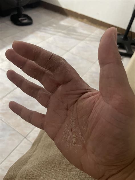 the cut that always bleeds 5