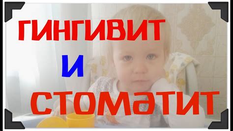 СТОМАТИТ и ГИНГИВИТ / симптомы / наша проблема и лечение - YouTube