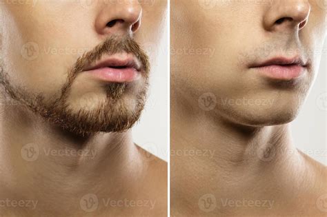 Male face Before and after shaving comparison. 16233976 Stock Photo at
