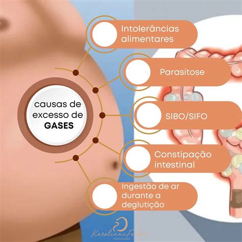 Excesso De Gases E Arrotos - Dra. - A formação de gases ocorre como um processo natural no tubo ...