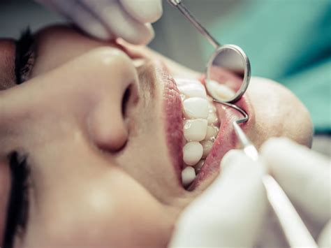 gingivectomy  ahwatukee phoenix az procedure atrium dental