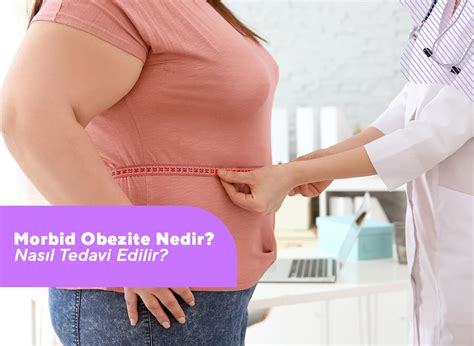 Morbid Obezite Nedir? Nasıl Tedavi Edilir? | Op.Dr Mücteba Gündüz