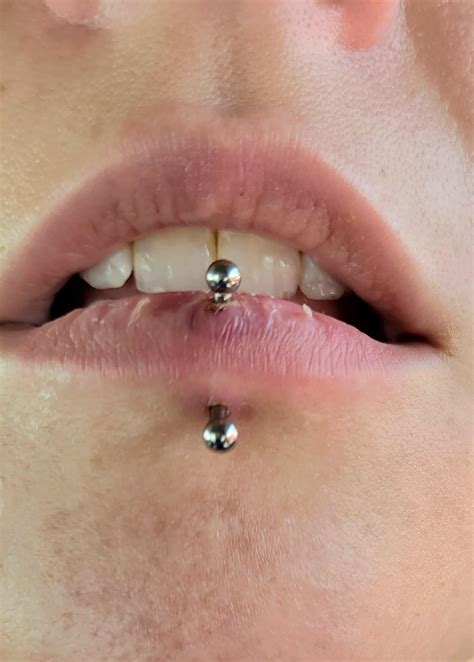 14g vertical labret 3 days old.. is this amount of bruising normal? : r ...