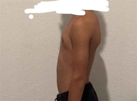 how to fix shoulder blades sticking out