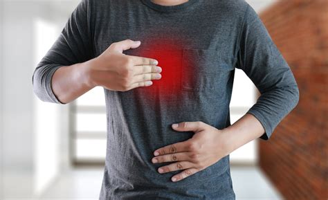Gastroesophageal reflux disease | The Surgery Group