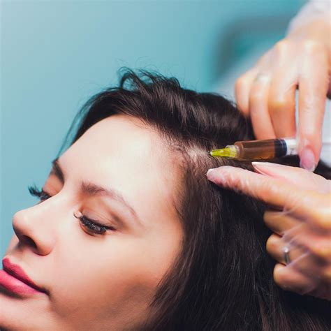 PRP (Platelet-Rich Plasma) For Hair Loss | Tranz4me