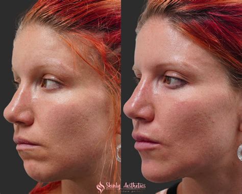 This ChloeDifataa Image: A Before & After You Won't Believe Image 7