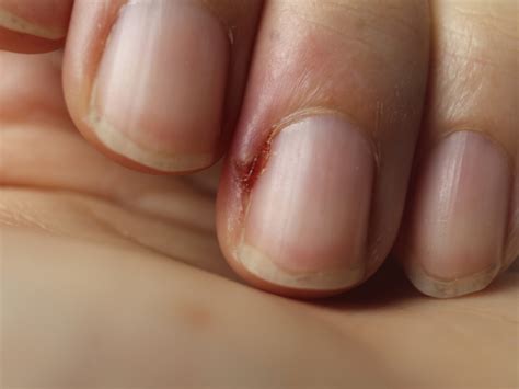 Are Your Nails Trying to Tell You Something? Beware of These Vertical Warning Signs!