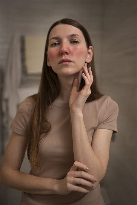 Acne Scar Treatment in Dubai | Elite Style Polyclinic