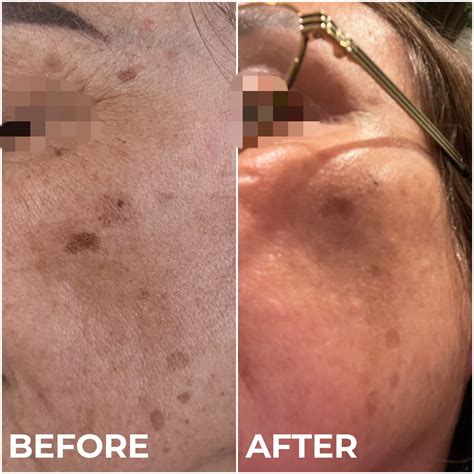 Medical students debate the fairness of the dermatology pa salary 18