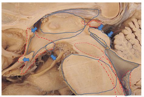 3) Midbrain Diagram | Quizlet