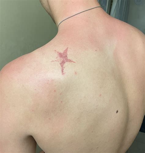 How does my star birthmark look? : r/StardustCrusaders