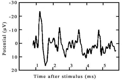 Example of an evoked potential. | Download Scientific Diagram
