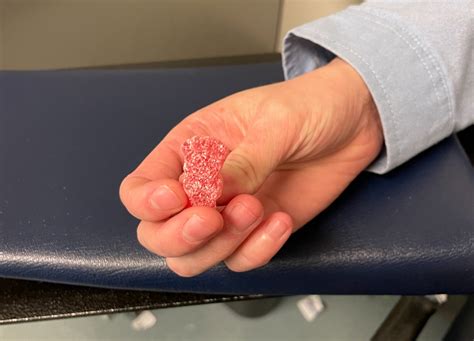 Allergy Blood Test Prep For Kids: How To Make It Less Scary — Friendly