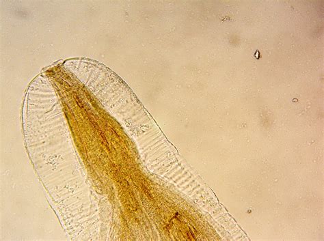 Enterobius Vermicularis In Stool