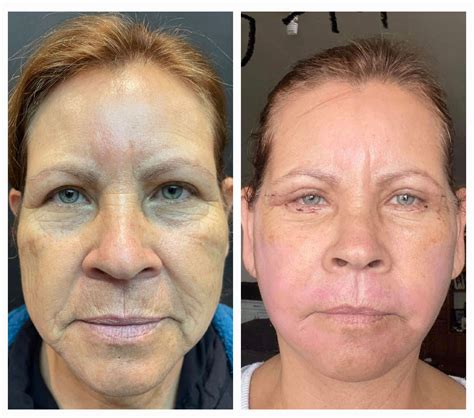 Amazing Before-After Pictures Reveals Jaw-Dropping Results!