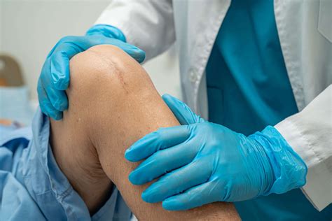 Wound Care After Surgery: Healing Post Surgical Wounds