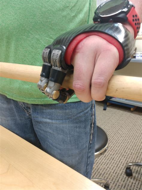 Riding a Bicycle When You Have an Upper Limb Difference