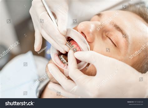 treatmenting images stock  vectors shutterstock