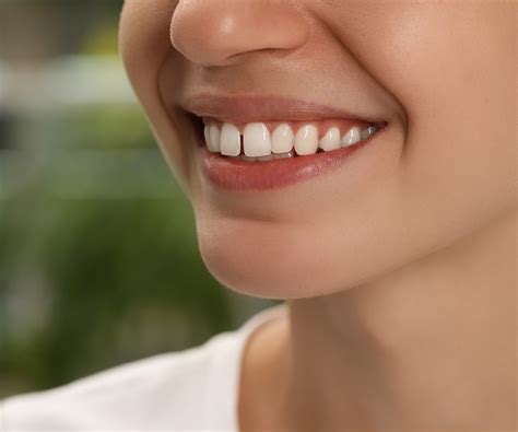 Overbite: Before and After Treatment at BHO