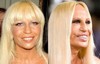 Has Donatella Versace had Plastic Surgery Gone Wrong Before and After ...