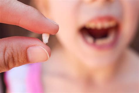 The Meaning of Teeth Falling Out in Dreams: Unlocking the Enigma - Onedio