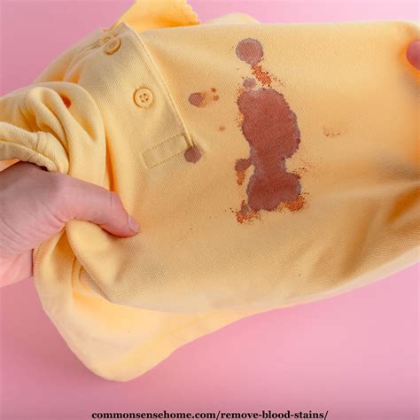 how to get blood stain out of clothes