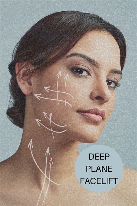 deep plane facelift surgery artofit
