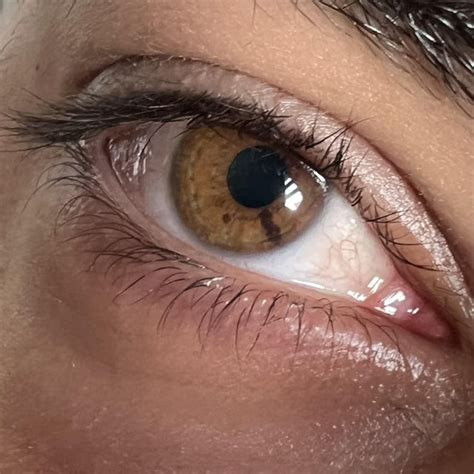 radial symmetry   morphological characteristic   echinoderms