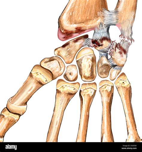 lateral ulnar collateral ligament