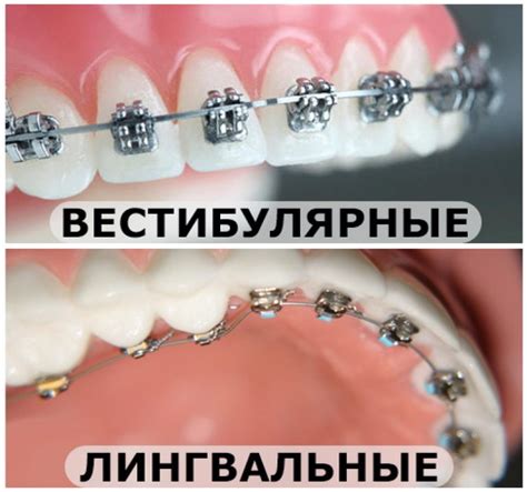 Статьи