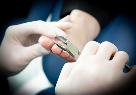 Medical Pedicure (Medi Pedi) Sydney | Private Health Rebates Available