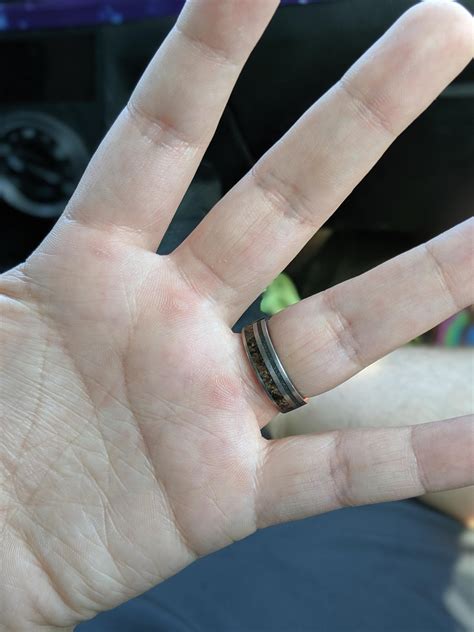 My calluses are coming back! : r/FTMFitness