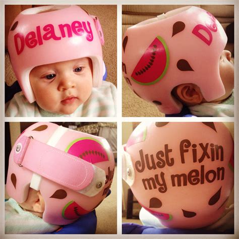 Baby helmet tips what we learned from a cranial helmet – Artofit